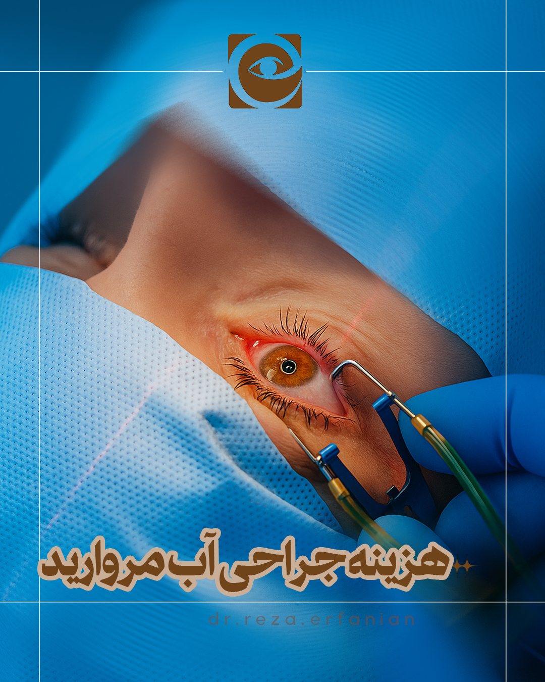 هزینه جراحی آب مروارید
