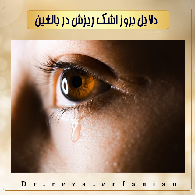 اشک ریزش در بزرگسالان