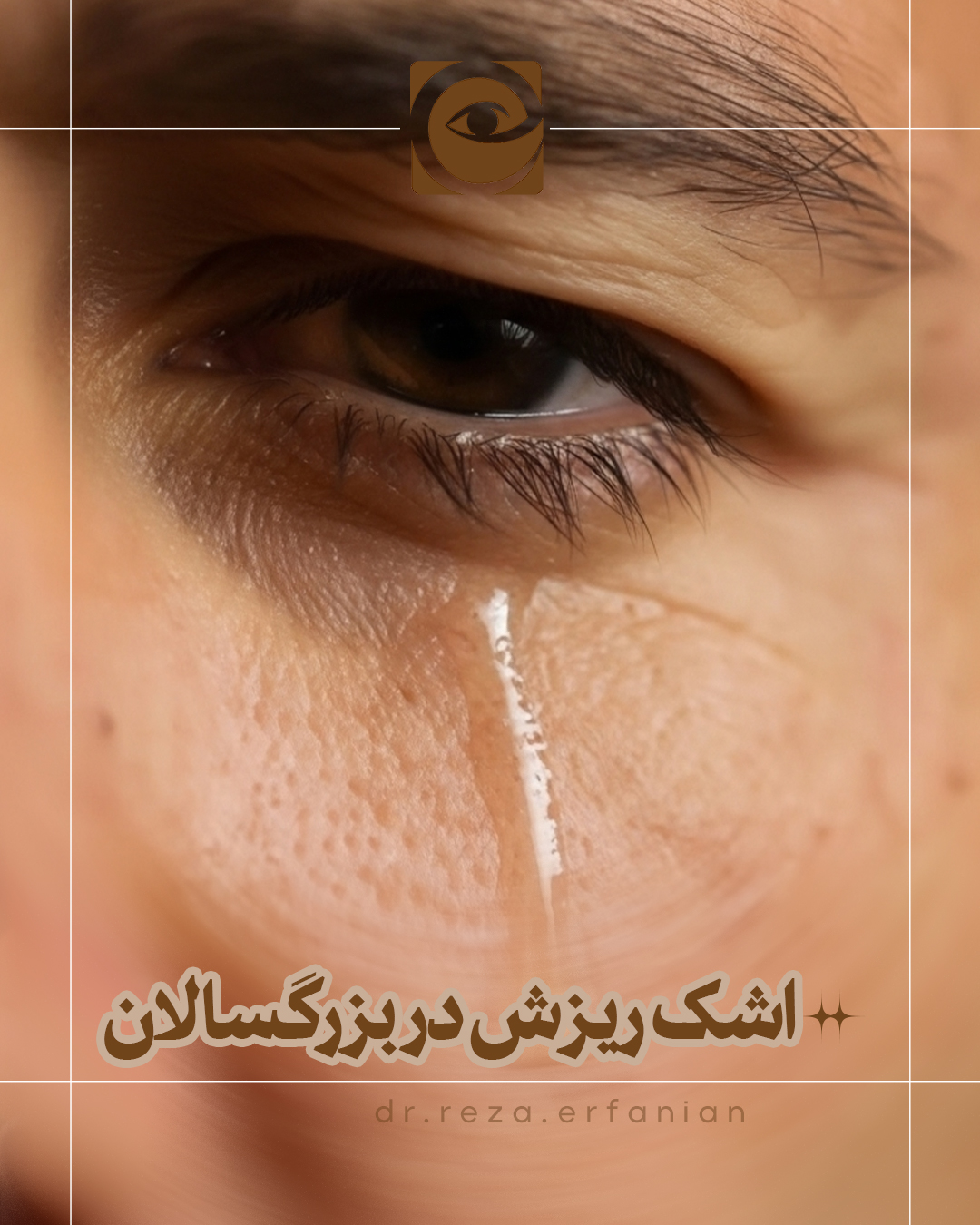 بروز اشک ریزش در بزرگسالان