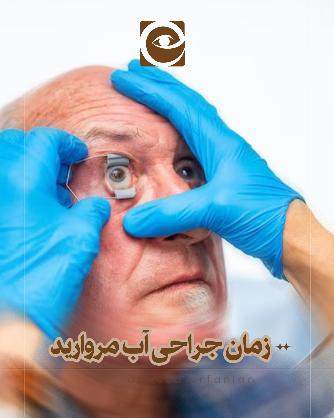 جراحی آب مروارید