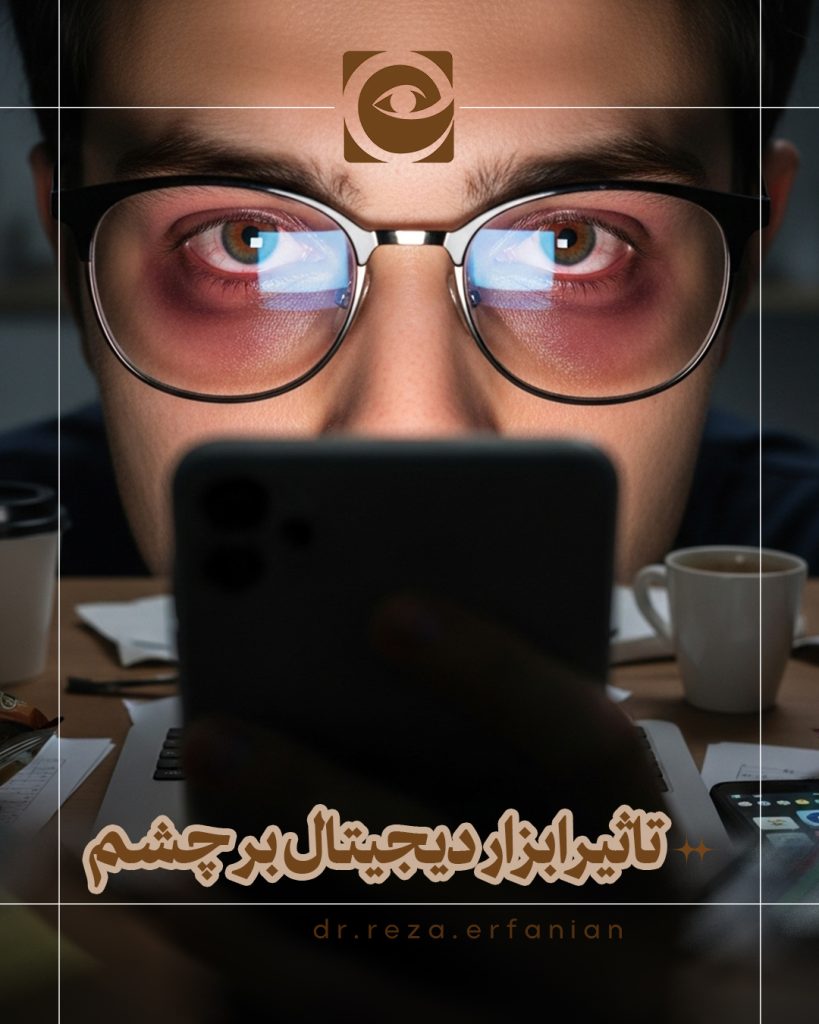 انتخاب تاثیر استفاده طولانی از ابزارهای دیجیتال بر چشم ها تاثیر استفاده طولانی از ابزارهای دیجیتال بر چشم ها