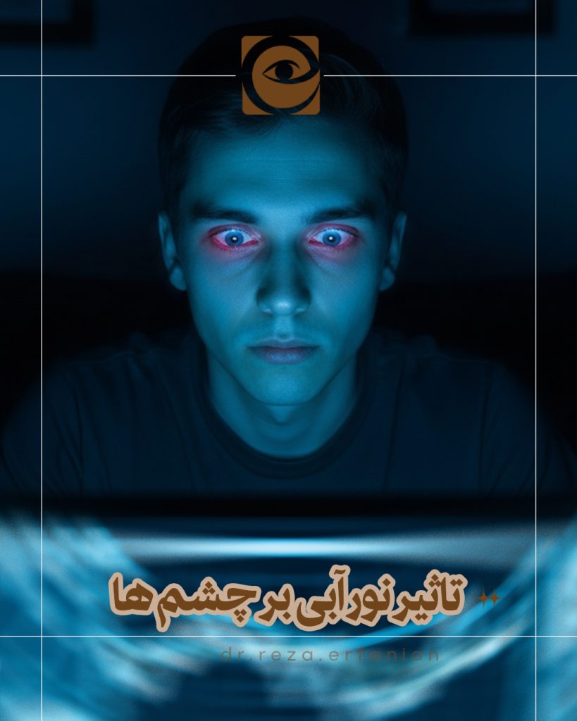 تاثیر نور آبی بر چشم ها