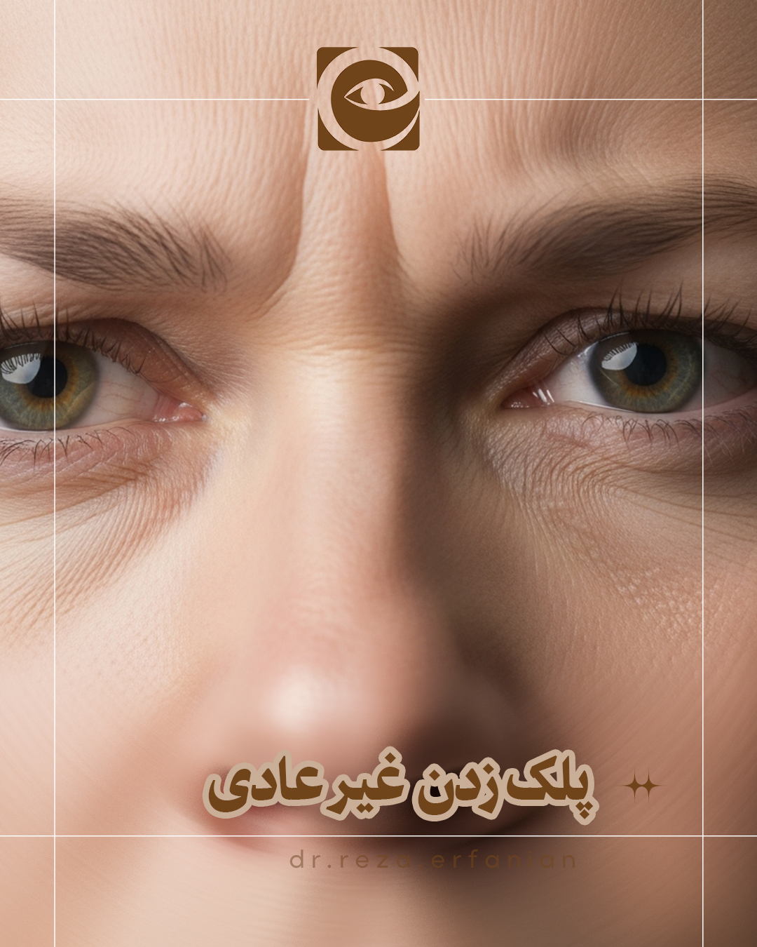 بلفارواسپاسم یا پلک زدن غیر عادی