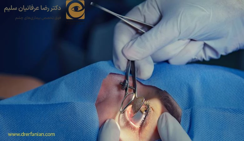 علائم انسداد مجرای اشکی