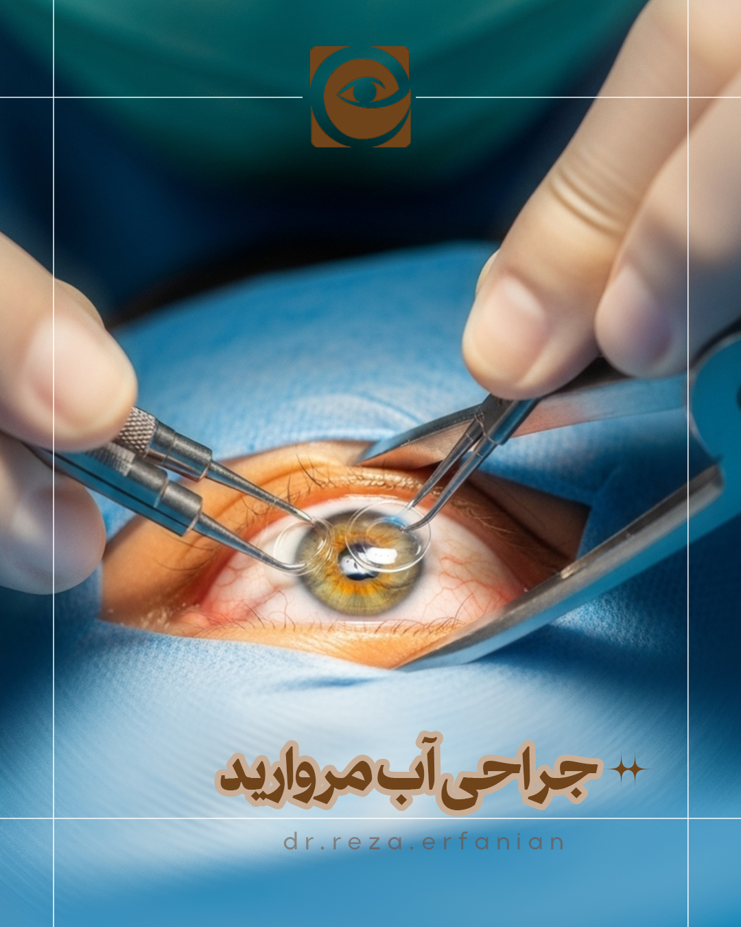 جراحی آب مروارید