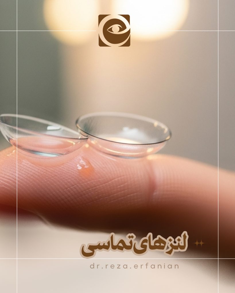 لنز های تماسی