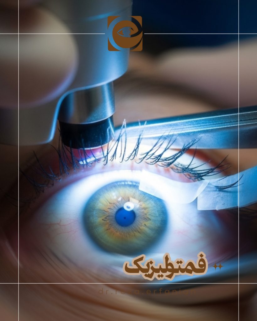 فمتولیزیک
