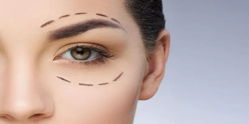 مراقبت های بعد از جراحی پلک