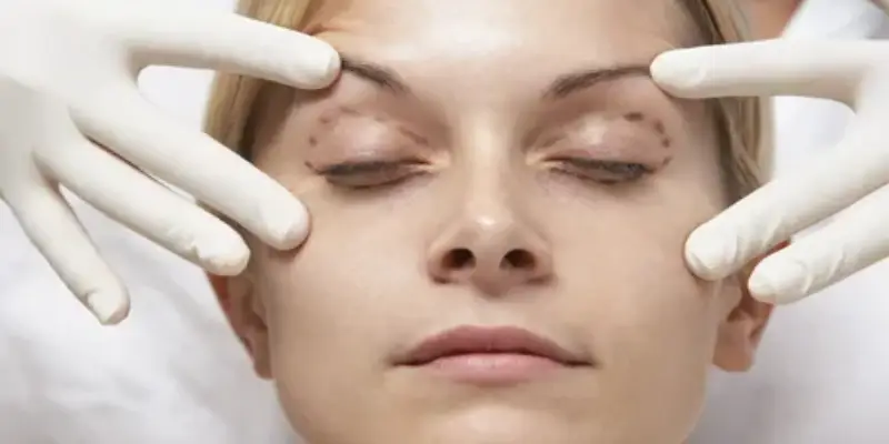 مراقبت های بعد از جراحی پلک و و مصرف دارو