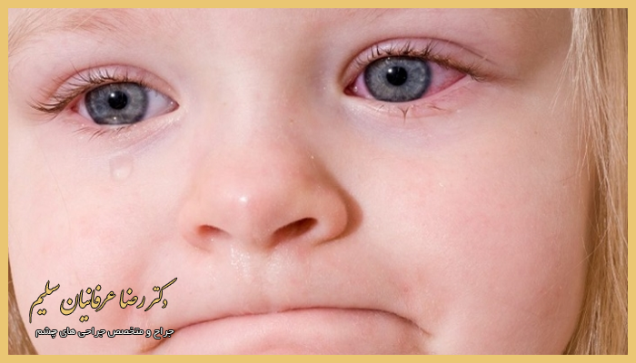 مهم ترین علت اشک ریزش در کودکان