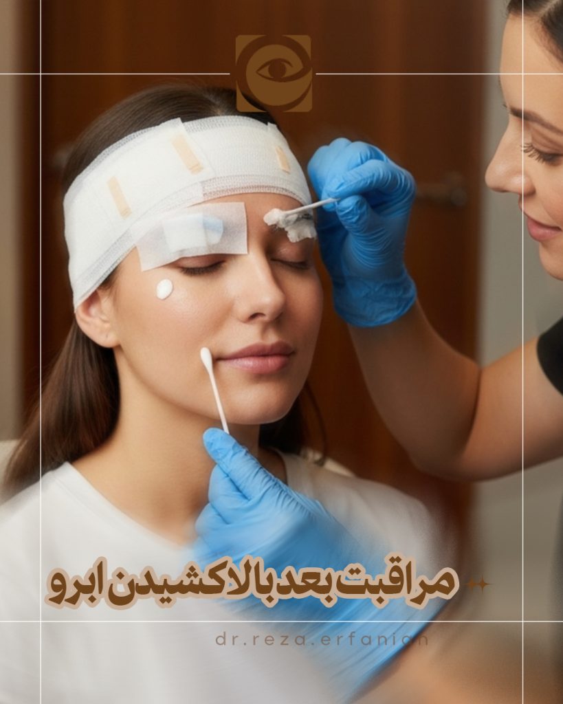 مراقبت های بعد از بالا کشیدن ابرو