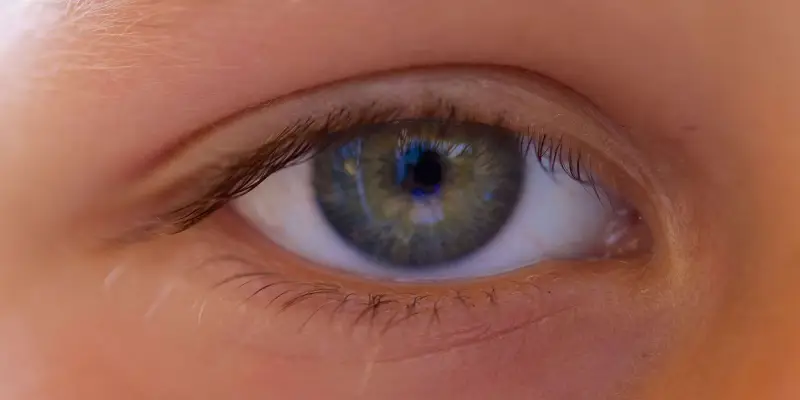 انحراف چشم در کودکان