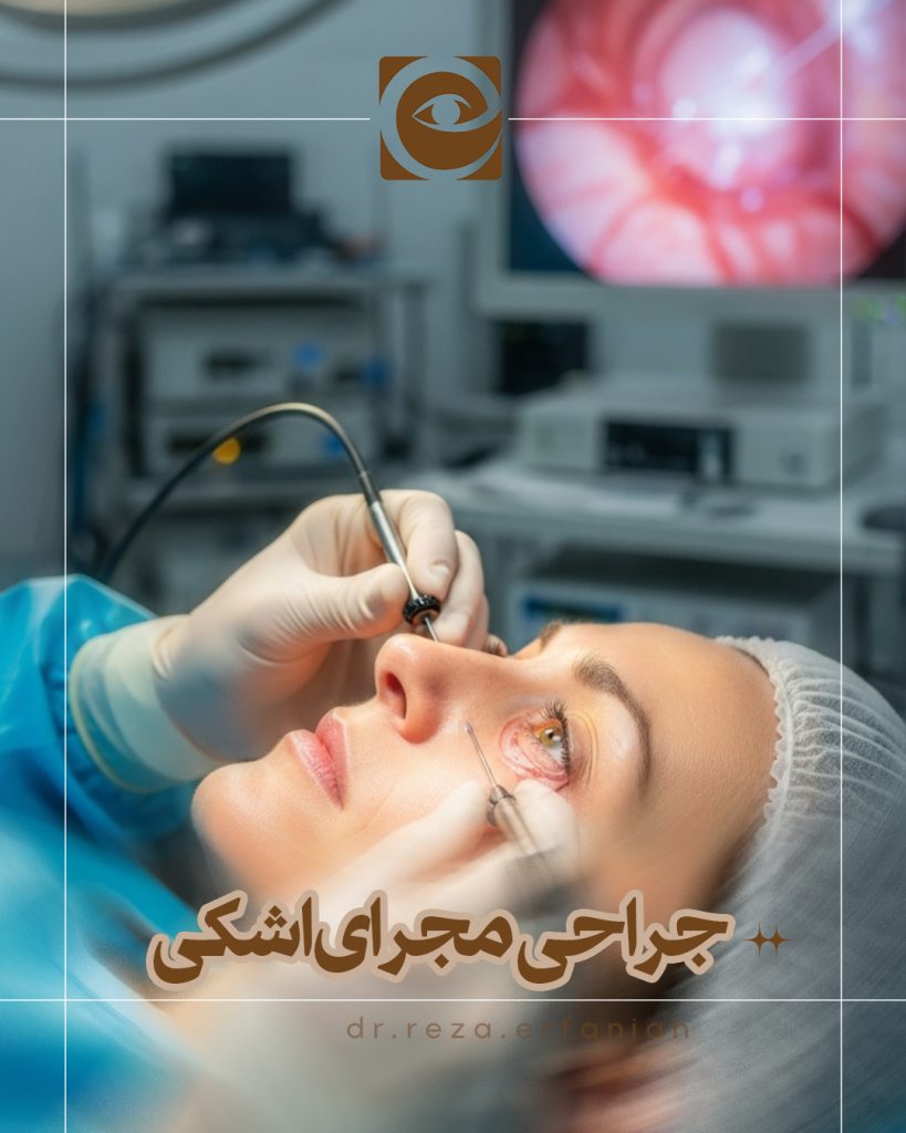 جراحی انسداد مجرای اشک به روش اندوسکوپیک  
