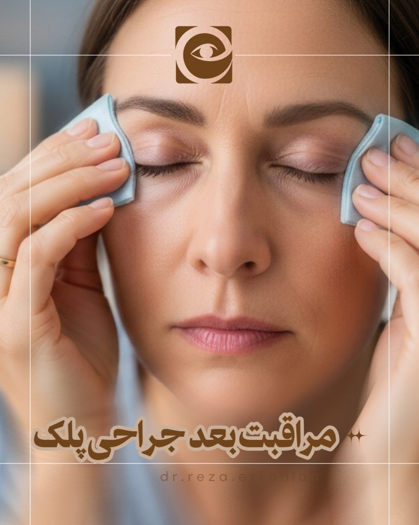 مراقبت های بعد از جراحی پلک