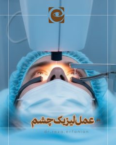 عمل لیزیک