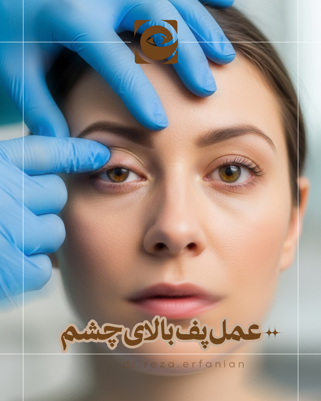 عمل پف بالای چشم