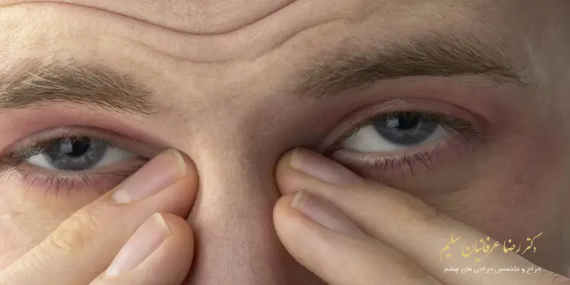 انواع عفونت چشم