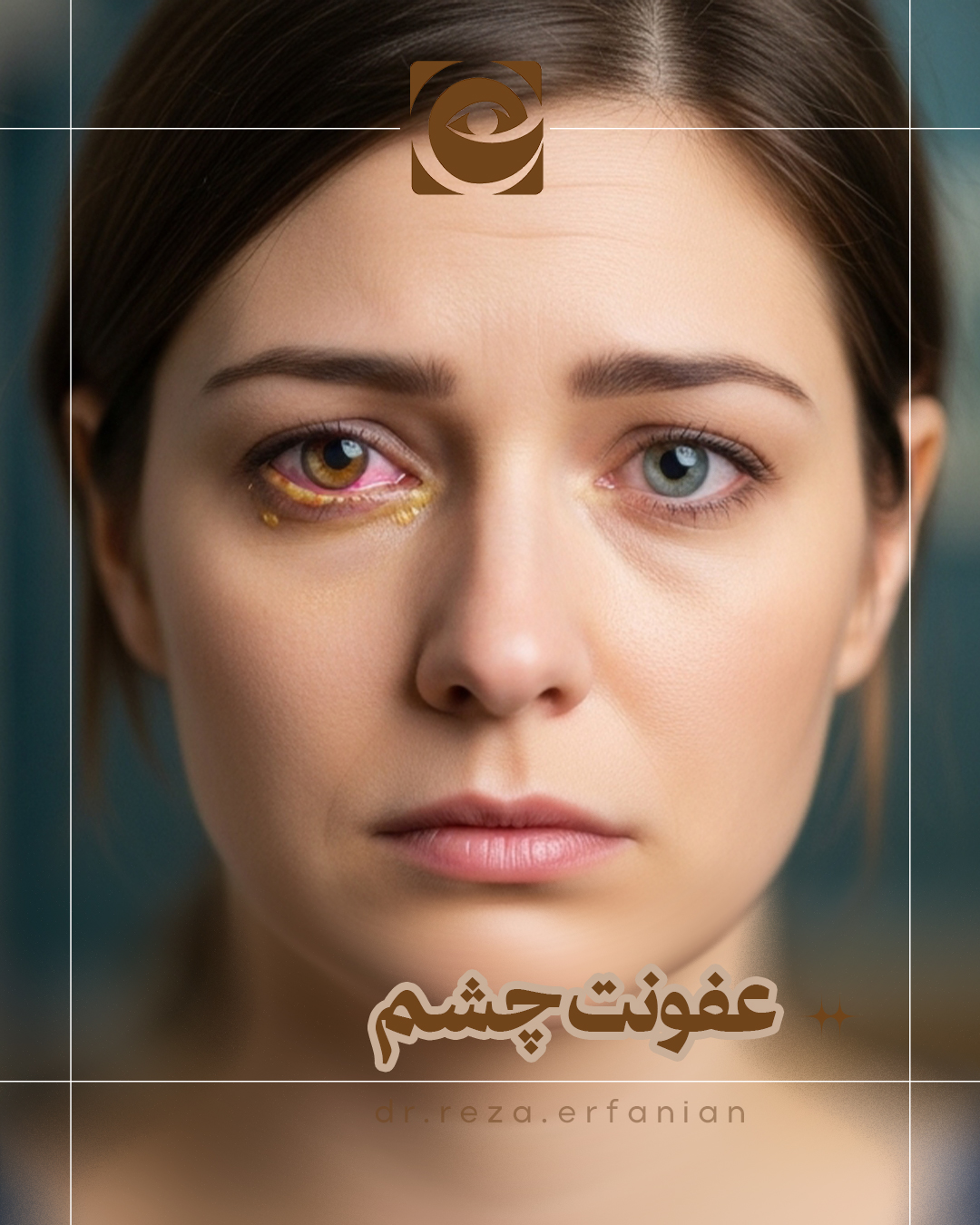 عفونت چشم
