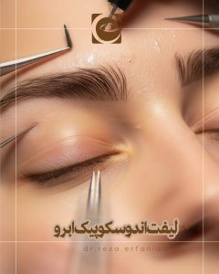 لیفت اندوسکوپیک ابرو