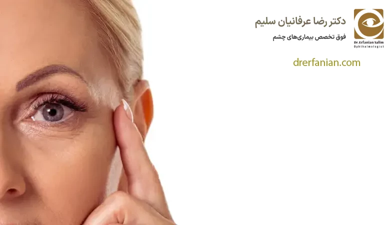 نحوه ی انجام جراحی ترمیم بلفاروپلاستی
