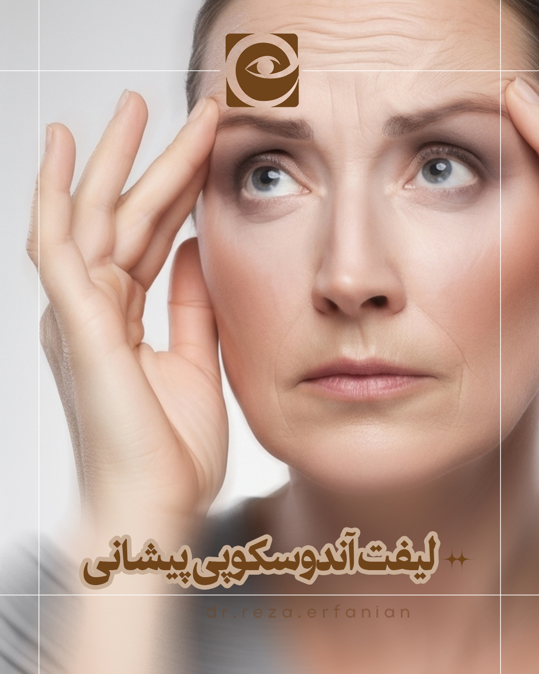 لیفت آندوسکوپی پیشانی