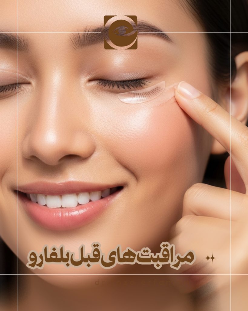 مراقبت‌های قبل از جراحی بلفاروپلاستی