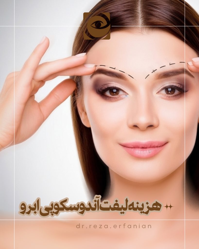 هزینه لیفت آندوسکوپی ابرو
