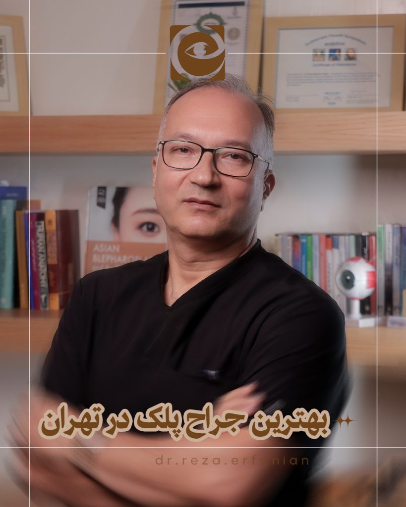 بهترین جراح پلک در تهران