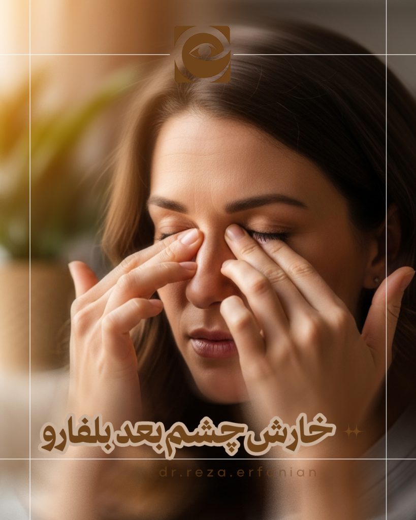 خارش چشم پس از بلفاروپلاستی