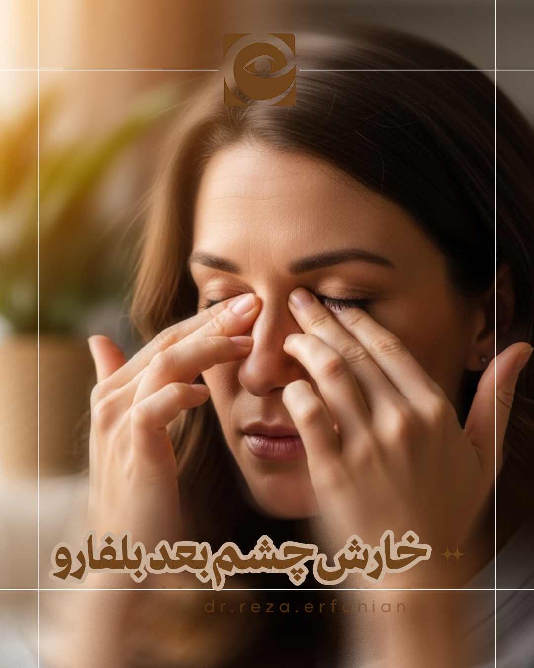 خارش چشم پس از بلفاروپلاستی