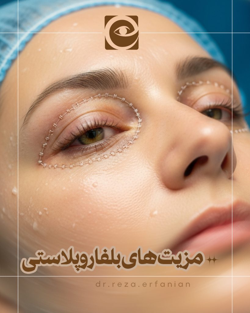 مزیت‌های بلفاروپلاستی