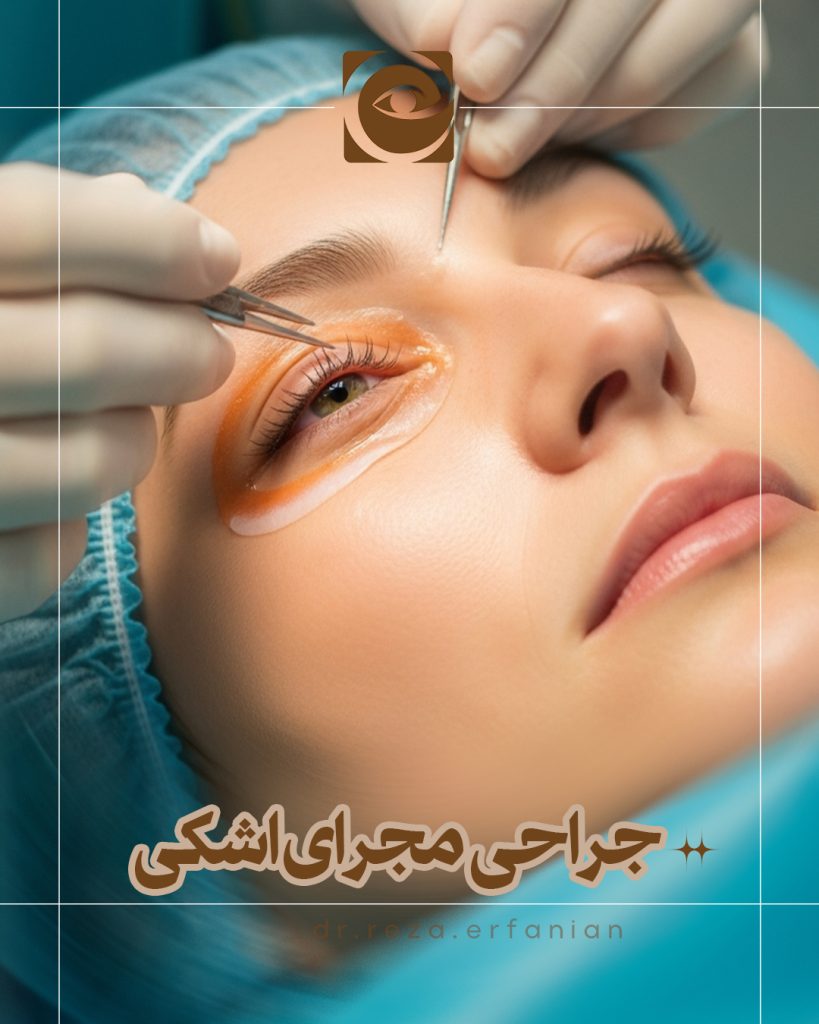 هزینه جراحی مجرای اشکی