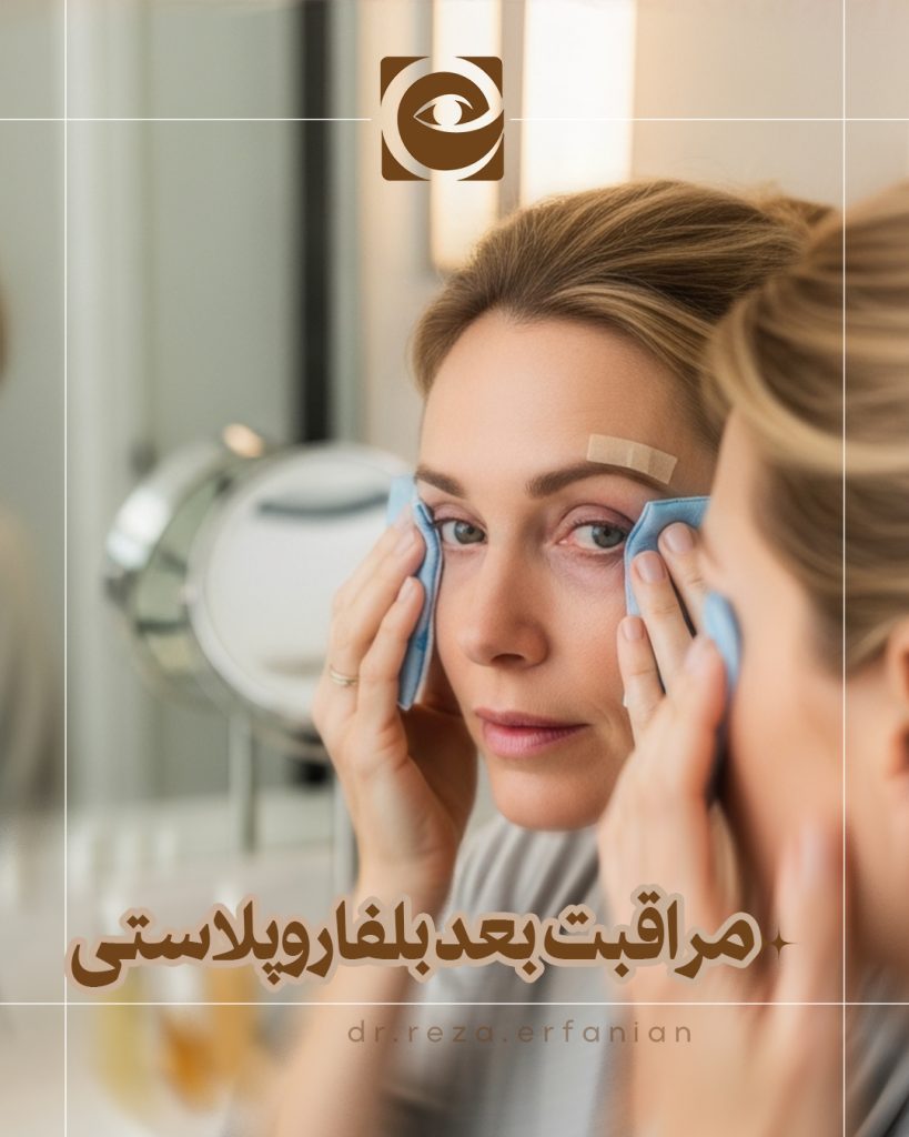 مراقبت های بعد از بلفاروپلاستی