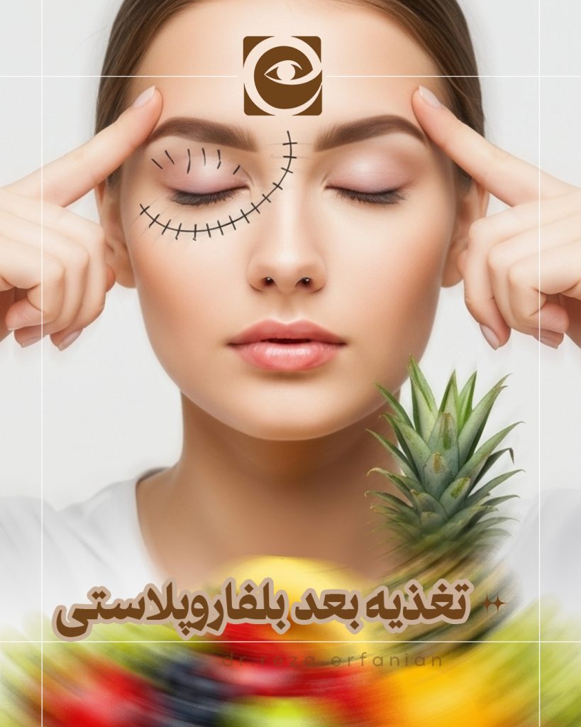 تغذیه بعد از بلفاروپلاستی
