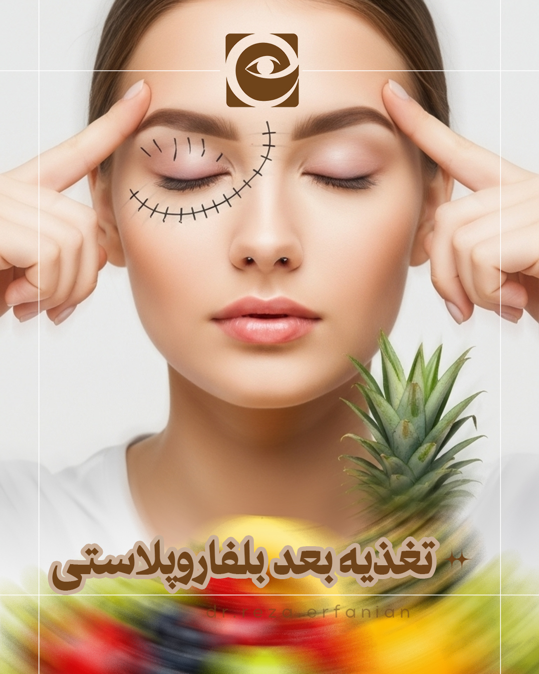 تغذیه بعد از بلفاروپلاستی