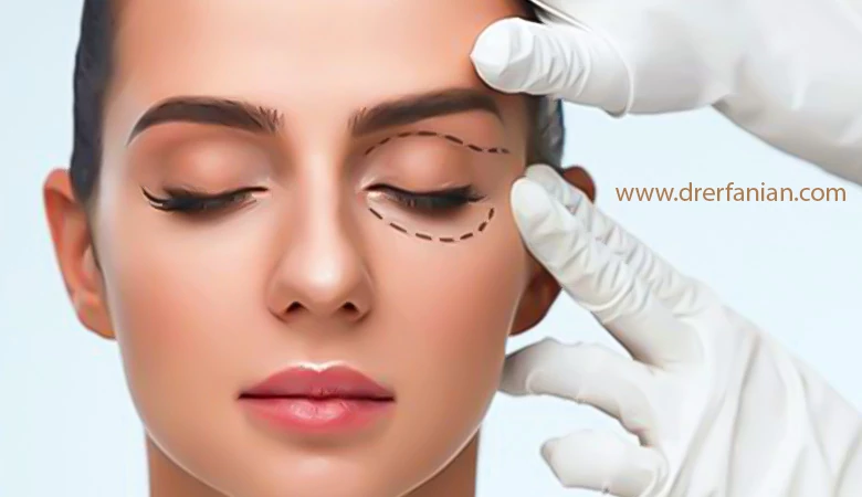 تفاوت در روش جراحی بلفاروپلاستی و لیفت شقیقه تفاوت در روش جراحی بلفاروپلاستی و لیفت شقیقه