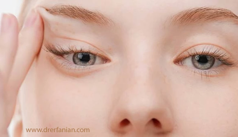 تفاوت ماندگاری عمل لیفت شقیقه و بلفاروپلاستی تفاوت ماندگاری عمل لیفت شقیقه و بلفاروپلاستی