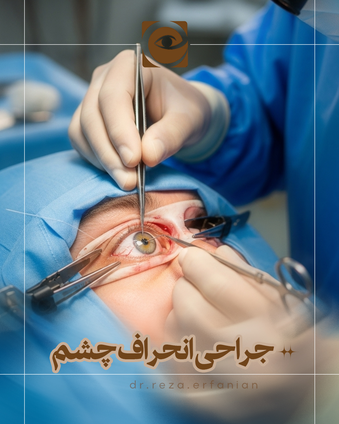 جراحی انحراف چشم