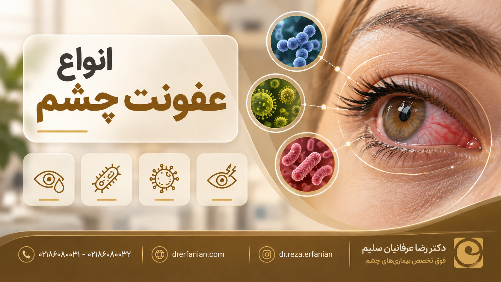 انواع عفونت چشم