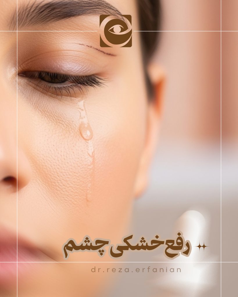 رفع خشکی چشم بعد از بلفاروپلاستی