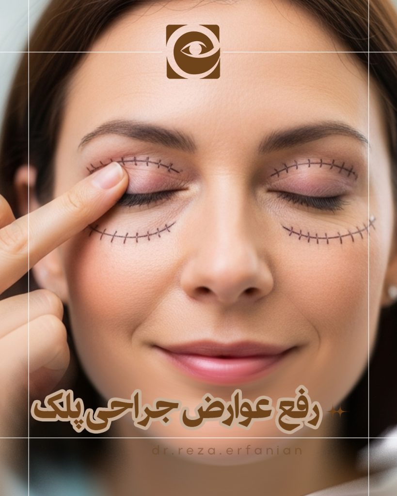 رفع عوارض جراحی با ترمیم بلفاروپلاستی