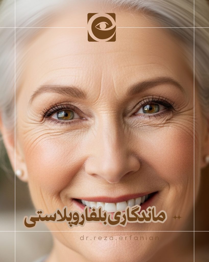 ماندگاری عمل بلفاروپلاستی
