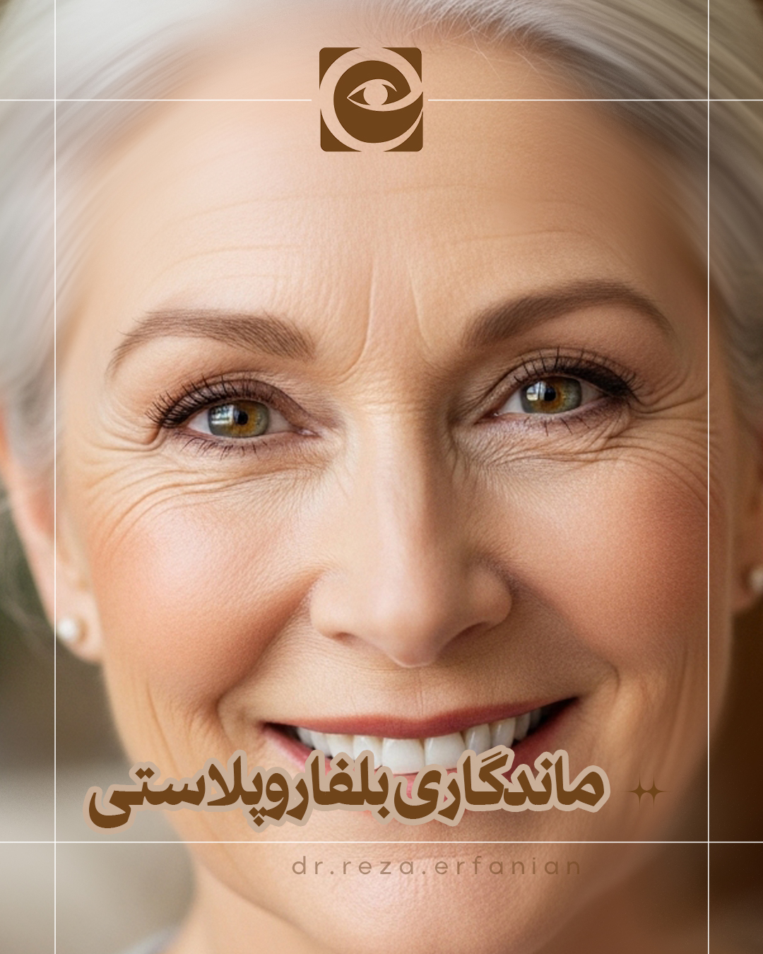 ماندگاری عمل بلفاروپلاستی