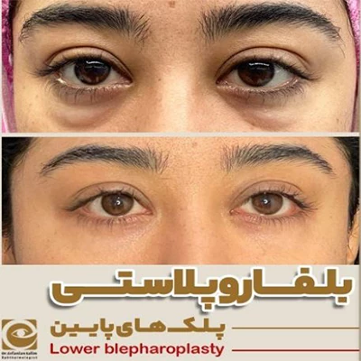 نحوه دستیابی برای مراجعه به بهترین جراح پلک در جردن