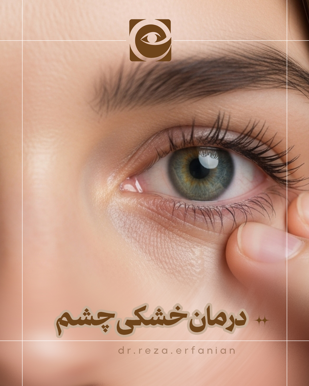 درمان خشکی چشم