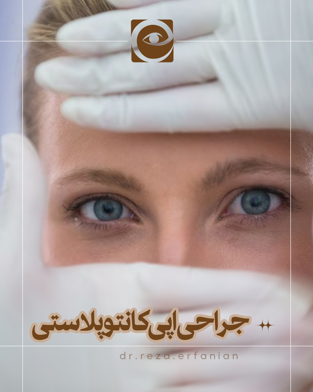 جراحی اپی کانتوپلاستی