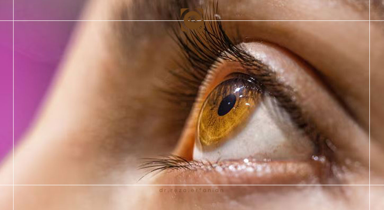 قرنیه چشم کجاست؟
