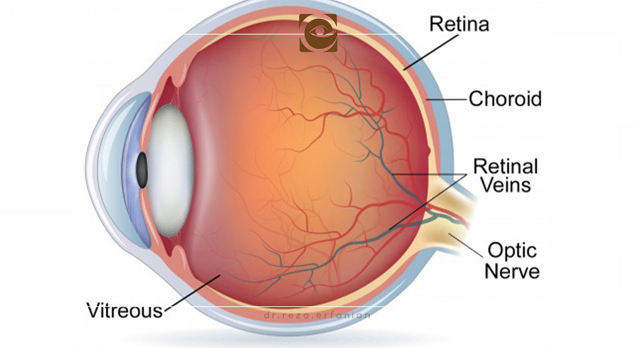 تشخیص و درمان مشکلات یووآ