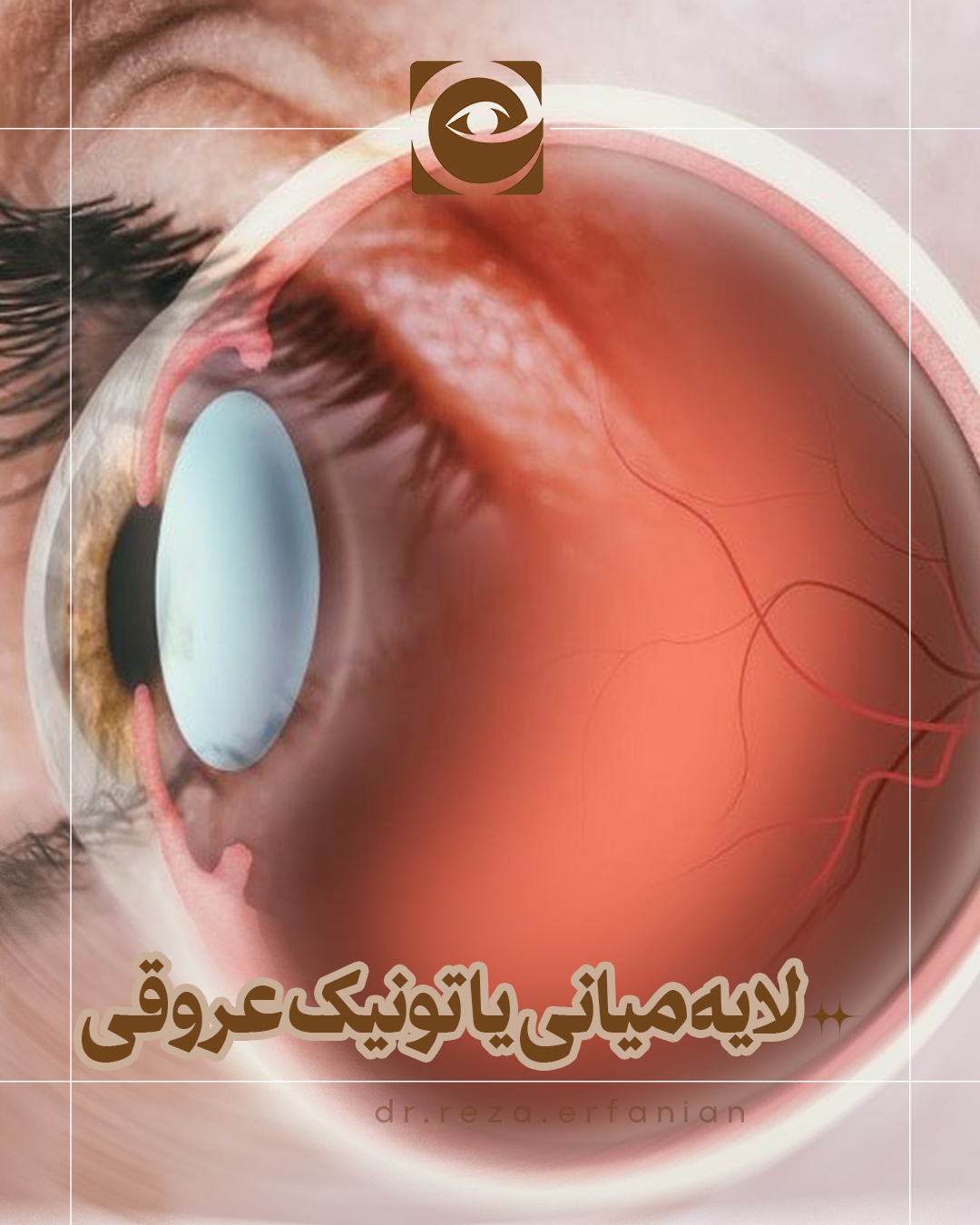 لایه میانی یا تونیک عروقی چشم