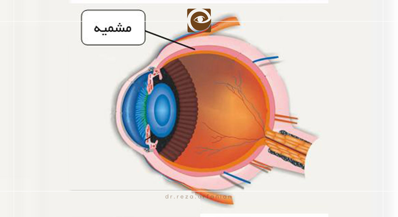موقعیت آناتومیک مشیمیه
